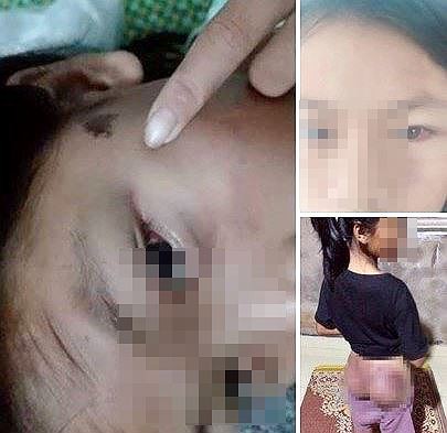 Công an viên đánh bé gái 12 tuổi tím người vì nghi trộm 50.000 đồng - Ảnh 1.