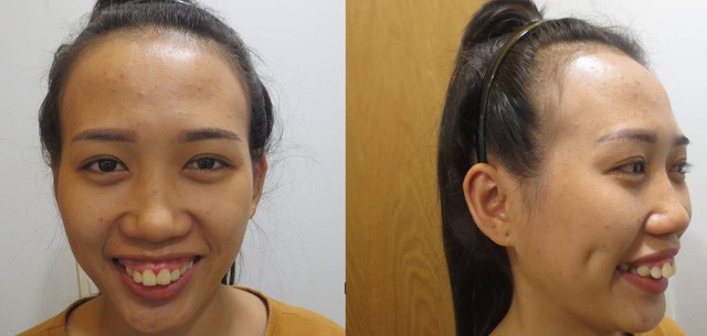 Ch&ecirc; bai người kh&aacute;c kh&ocirc;ng l&agrave;m bạn tốt hơn: H&atilde;y ngưng k&igrave; thị ngoại h&igrave;nh của những người k&eacute;m may mắn - Ảnh 1.