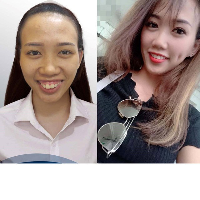 Ch&ecirc; bai người kh&aacute;c kh&ocirc;ng l&agrave;m bạn tốt hơn: H&atilde;y ngưng k&igrave; thị ngoại h&igrave;nh của những người k&eacute;m may mắn - Ảnh 3.