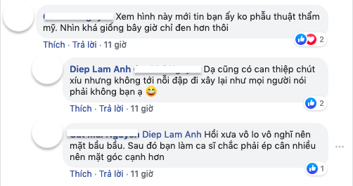 Khoe ảnh 13 năm trước, Diệp Lâm Anh không ngại thừa nhận nhan sắc &quot;có can thiệp chút&quot; - Ảnh 3.