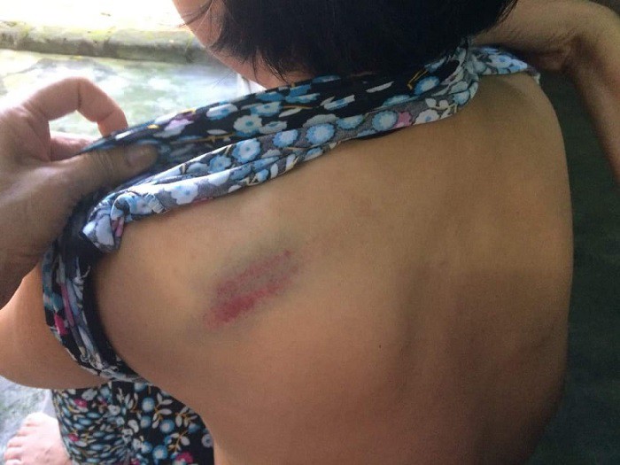 Cháu ngoại đánh bà gãy 5 xương sườn ở Quảng Ninh: Gia đình vẫn kiên quyết để pháp luật xử lý - Ảnh 1.