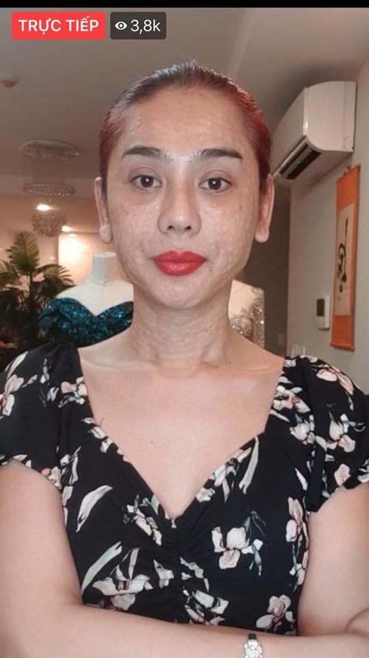Sốc với nhan sắc xuống cấp, lộ da mặt sần sùi sau 7 năm phẫu thuật chuyển giới của Lâm Khánh Chi - Ảnh 1.