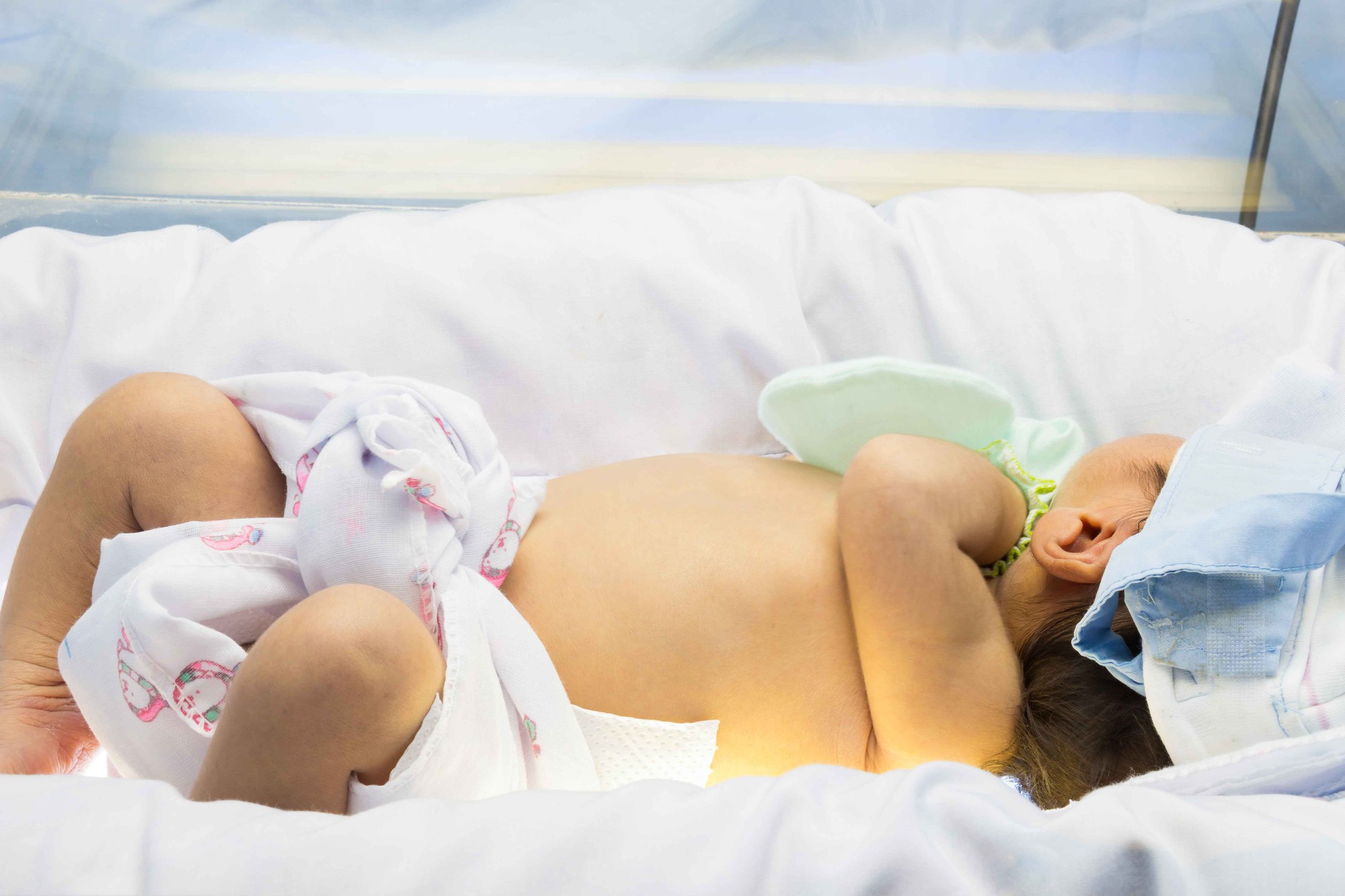 Новорожденному после. Желтуха у недоношенных новорожденных. Естественное рождение ребенка. Физиологическая желтуха новорожденных фото.