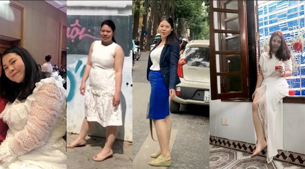 Cô gái Hà Nội nặng gần 100 kg cắt dạ dày để giảm cân - Ảnh 1.
