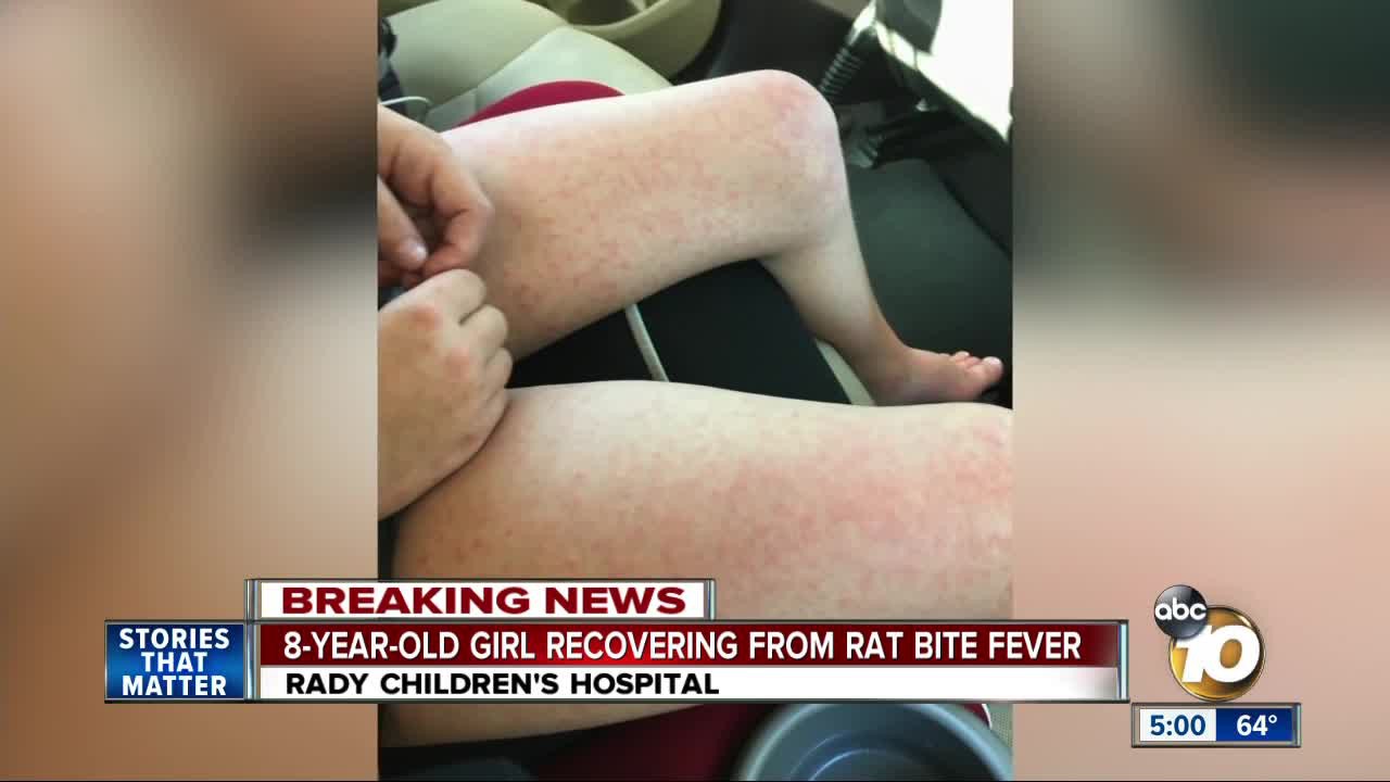 Lây bệnh từ thú cưng, cô bé 8 tuổi bị bị sốt hơn 40 độ C, đau đớn đến nỗi không ai dám chạm vào: Lời cảnh báo của mẹ bé và bác sĩ - Ảnh 1.