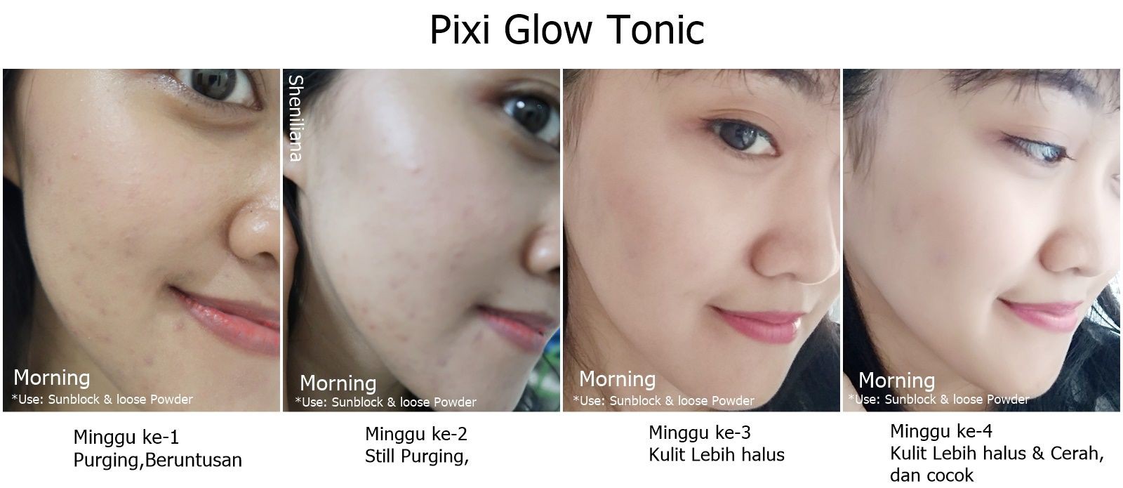 Không có tiền mua chai toner siêu xịn giá 2,6 triệu, bạn có thể tìm đến 6 phiên bản bình dân rẻ hều này  - Ảnh 2.