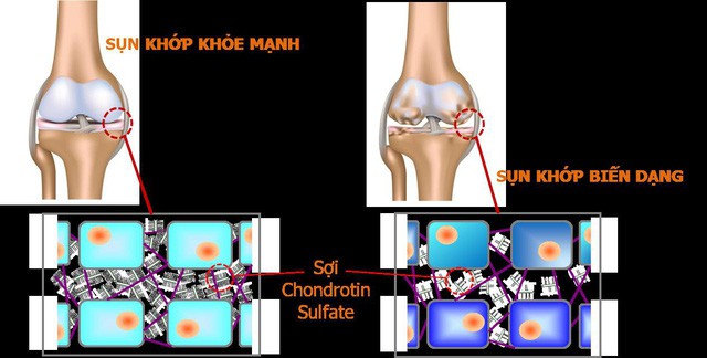 Học người Nhật cách chăm sóc sức khỏe xương khớp ở người cao tuổi - Ảnh 1.