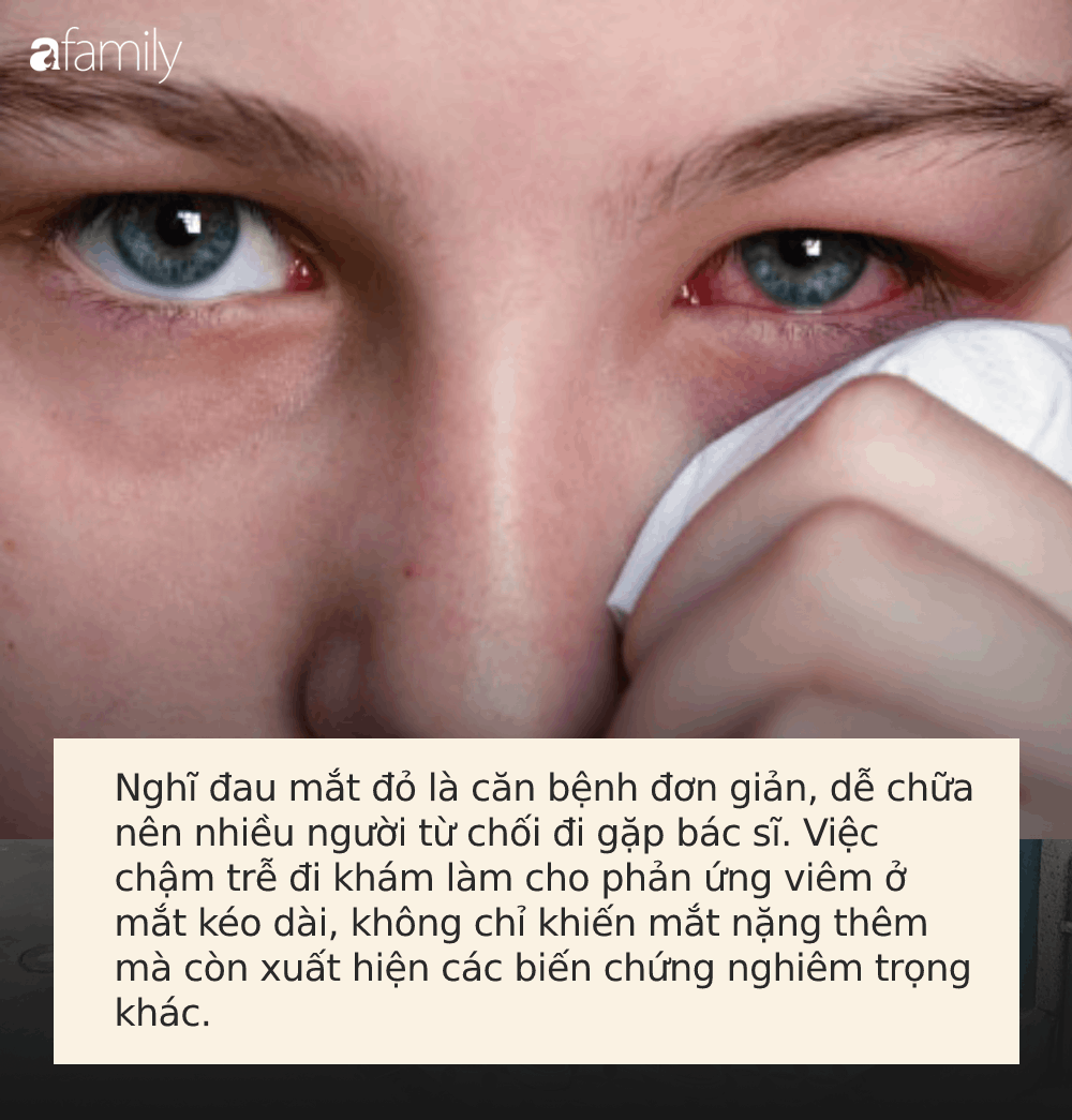 Đau mắt đỏ: Chớ dại làm 3 việc sau nếu không muốn bị loét giác mạc, mù vĩnh viễn - Ảnh 1.