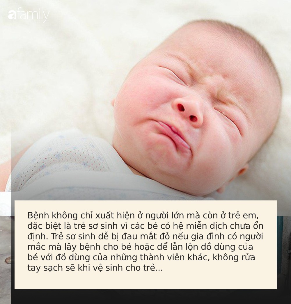 Trẻ sơ sinh bị đau mắt đỏ đừng vội dùng thuốc, mẹ cứ bình tĩnh làm cách này bé sẽ khỏi hoàn toàn chỉ sau vài ngày - Ảnh 1.