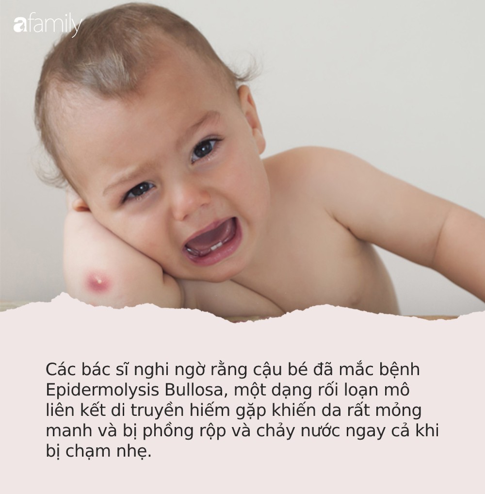 Bé trai bị bệnh viện trả về vì bẩm sinh không có da, y hệt “miếng thịt sống”, 8 tháng sau điều kỳ diệu đã đến - Ảnh 5.