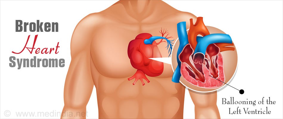 Khoa học chứng minh: Quá đau lòng hay quá hạnh phúc có thể làm tăng nguy cơ mắc bệnh ung thư - Ảnh 2.