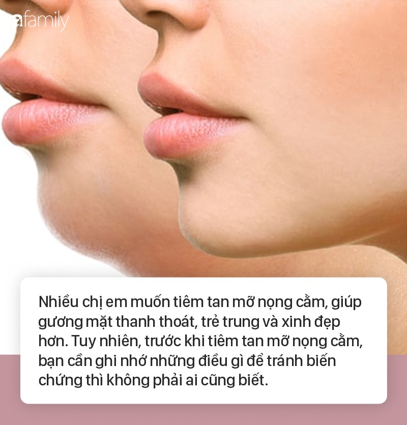 Tiêm tan mỡ nọng cằm giữ được bao lâu? Bí quyết duy trì hiệu quả dài lâu