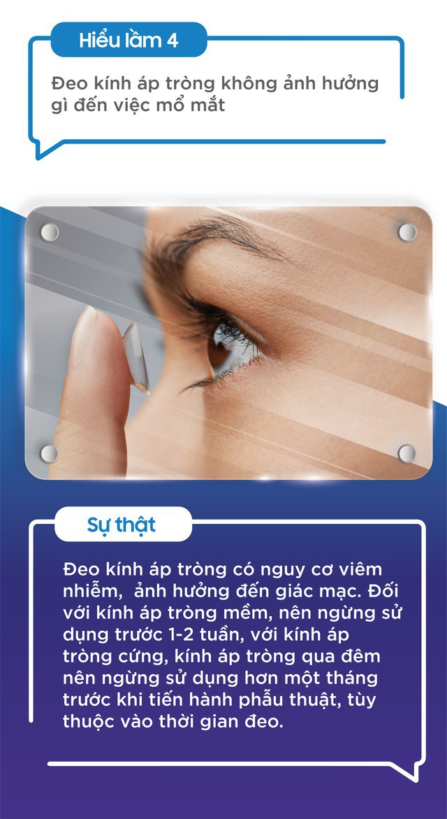 Top 5 hiểu lầm về phẫu thuật tật khúc xạ không phải ai cũng biết - Ảnh 4. Top 5 hiểu lầm về phẫu thuật tật khúc xạ không phải ai cũng biết - Ảnh 4.