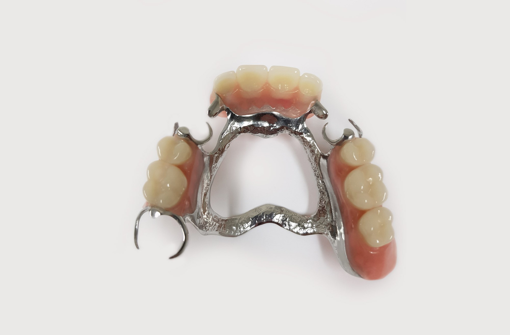 metal-frame-partial-dentures