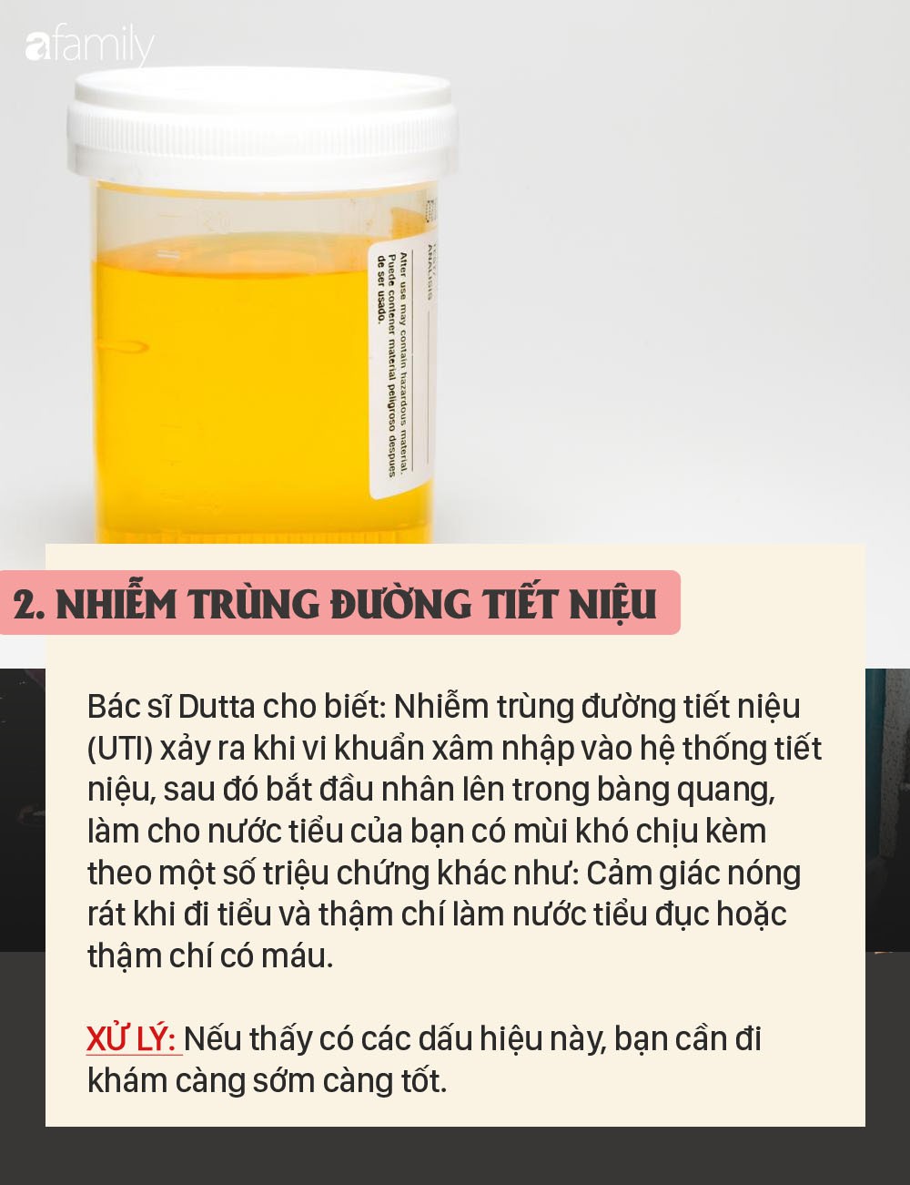 nuoc-tieu-co-mui-3