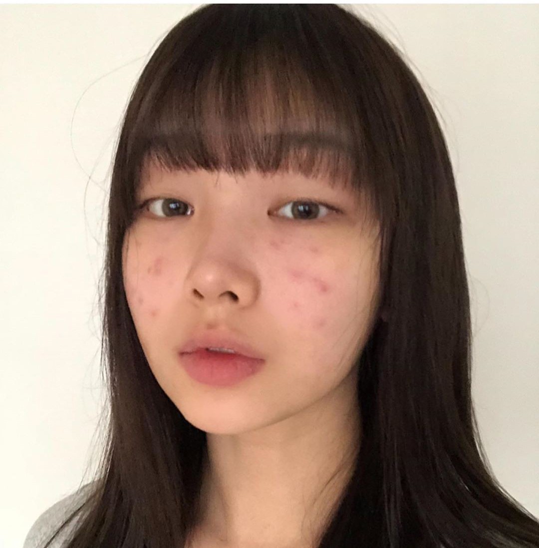 1 1