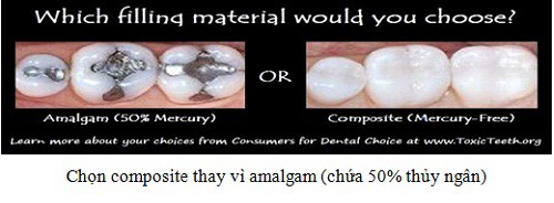 Amalgam – loại vật liệu hàn răng chứa Thủy ngân cần được loại bỏ - Ảnh 4.