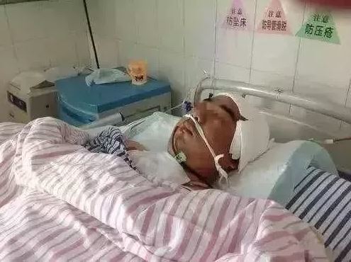 Người đàn ông đột quỵ trong giấc ngủ vì hành động sai lầm sau uống rượu - Ảnh 2. Người đàn ông đột quỵ trong giấc ngủ vì hành động sai lầm sau uống rượu - Ảnh 2.