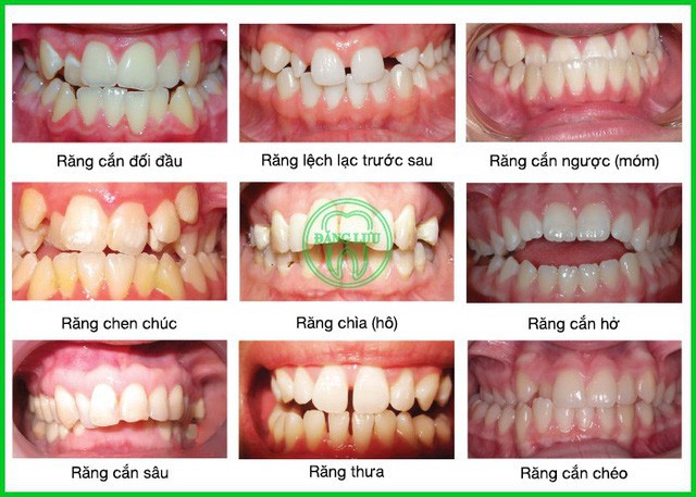 Khắc phục h&ocirc; m&oacute;m sớm cho con - Ảnh 3.