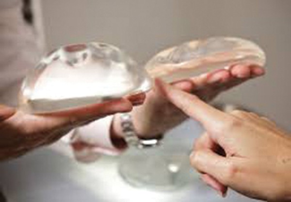 Những chuyện bi hài mang tên túi ngực silicon - Ảnh 2. Những chuyện bi hài mang tên túi ngực silicon - Ảnh 2.
