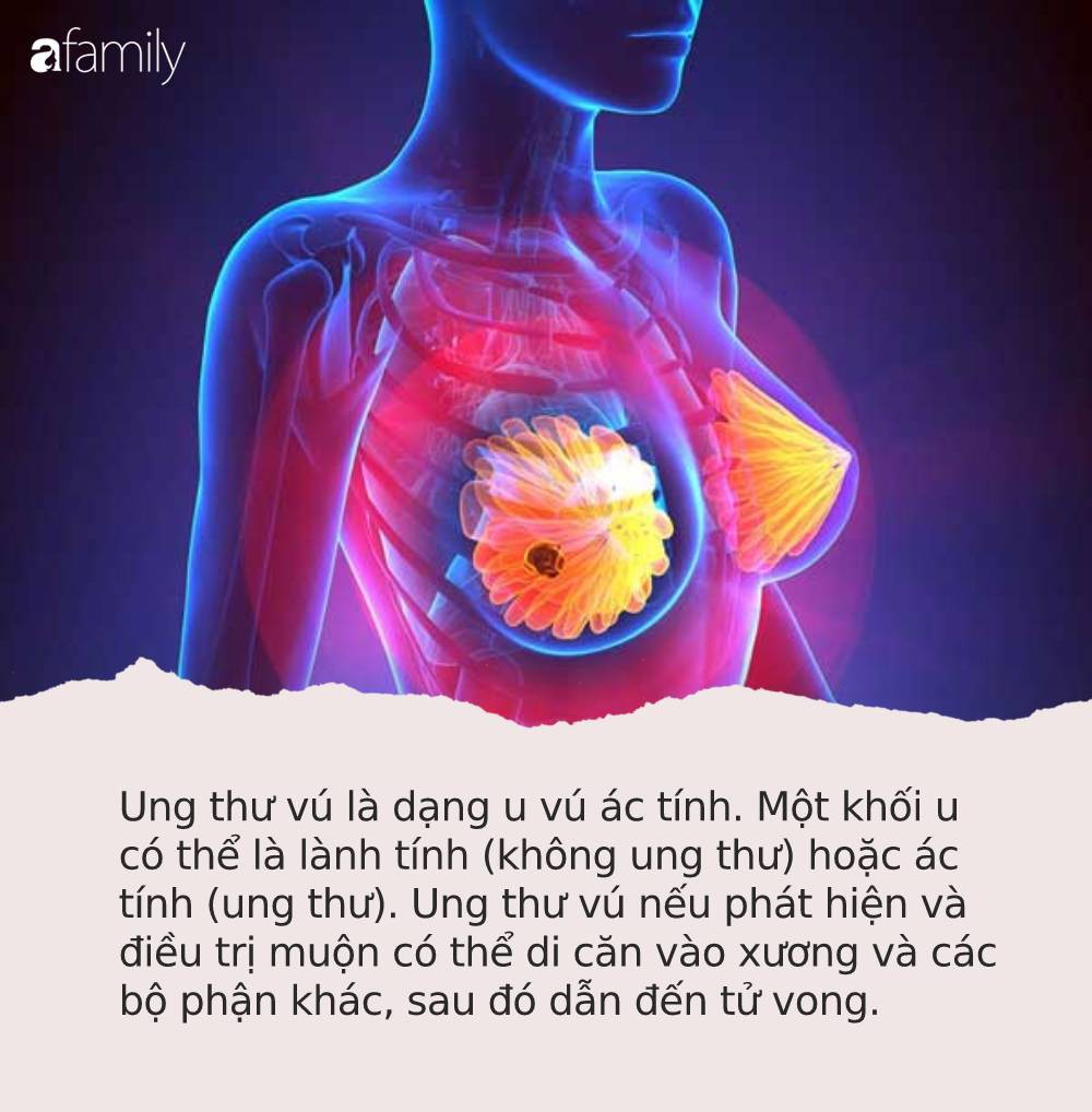 Phát hiện đồ lót của con gái 13 tuổi ra dịch vàng, mẹ dẫn đi siêu âm mới giật mình vì căn bệnh con đang mắc - Ảnh 3.