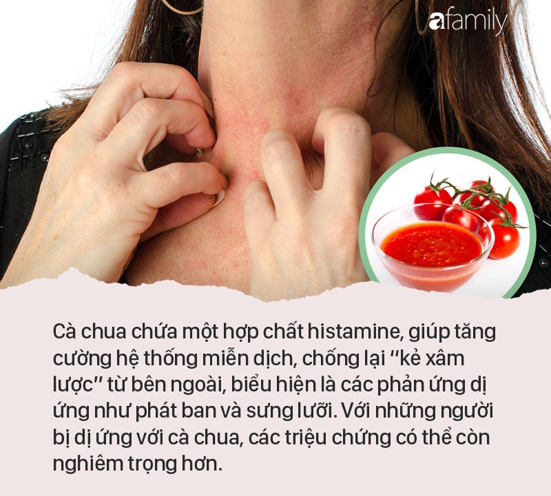 Dị Ứng Cà Chua: Nguyên Nhân, Triệu Chứng và Cách Điều Trị