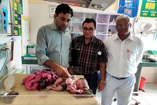 Mẹ bầu không siêu âm, sinh ra con có 3 tay 4 chân ở Ấn Độ - Ảnh 2.
