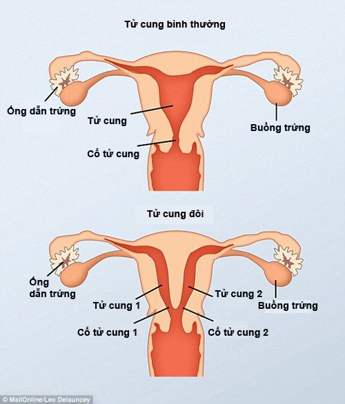 sinh-con-chua-day-thang-nguoi-phu-nu-bat-ngo-sinh-them-2-dua-nhin-vao-tu-cung-moi-ngo-ngang-1