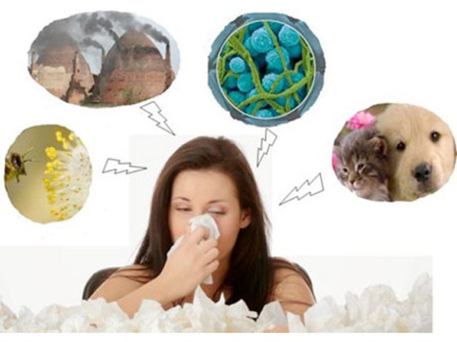 Viêm mũi dị ứng: Triệu chứng, yếu tố tăng nguy cơ và những người dễ bị viêm mũi dị ứng trong thời điểm giao mùa - Ảnh 2.