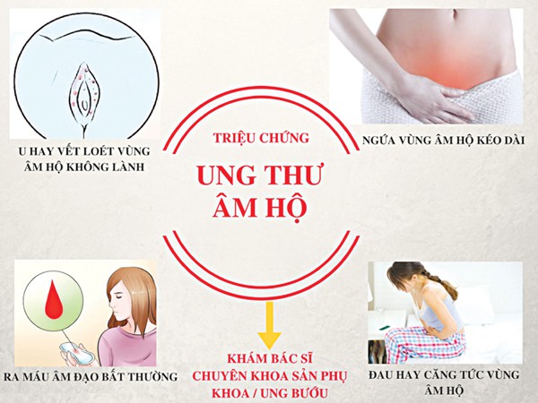 Tưởng chỉ là sợi lông mọc ngược vô hại ở vùng kín, ai ngờ lại là dấu hiệu của bệnh ung thư hiếm gặp - Ảnh 5.