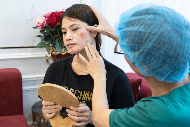 Cẩm nang trị mụn hiệu quả dành cho chị em 25-30 tuổi - Ảnh 1. Cẩm nang trị mụn hiệu quả dành cho chị em 25-30 tuổi - Ảnh 1.