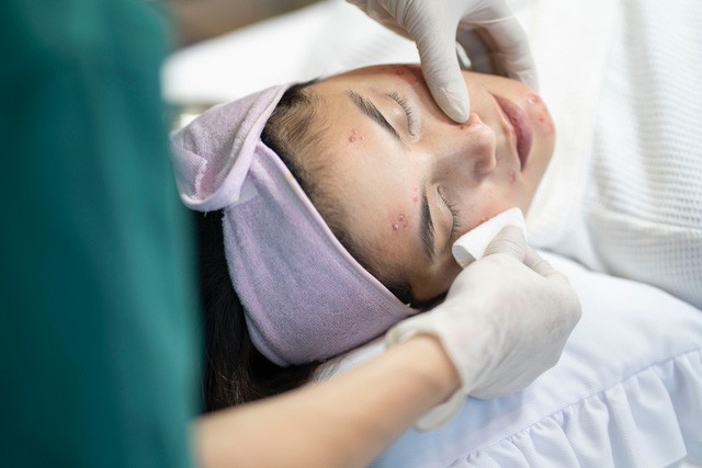 Cẩm nang trị mụn hiệu quả dành cho chị em 25-30 tuổi - Ảnh 4. Cẩm nang trị mụn hiệu quả dành cho chị em 25-30 tuổi - Ảnh 4.