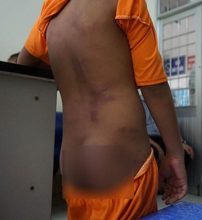 4 học sinh tiểu học bị bạo hành: Bị đánh và xát muối ớt vào vết thương - Ảnh 1.