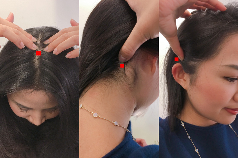 Đường ngôi tóc quá 0,8cm tức là bạn đang có nguy cơ hói, hãy ấn ngay vào 3 điểm này trên đầu để ngăn rụng tóc  - Ảnh 2.