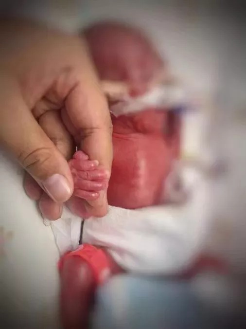 Em bé sinh non nặng 580g, chào đời trong tình trạng không có hô hấp, không mạch đập và may mắn sống sót - Ảnh 1.