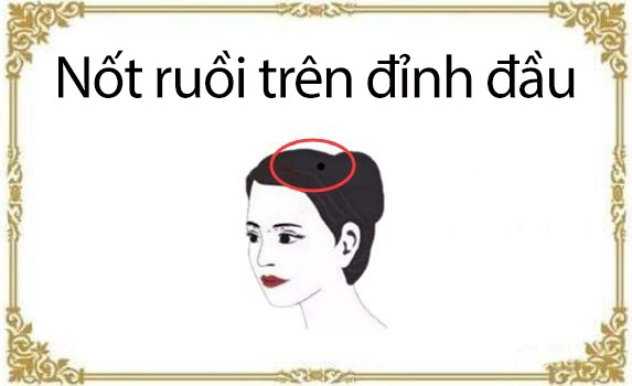 Phụ nữ có nốt ruồi trên bộ phận này, xác định cả đời không lo cơm áo gạo tiền, tài vận phú quý mỗi năm mỗi tăng, muốn nghèo cũng khó - Ảnh 1.