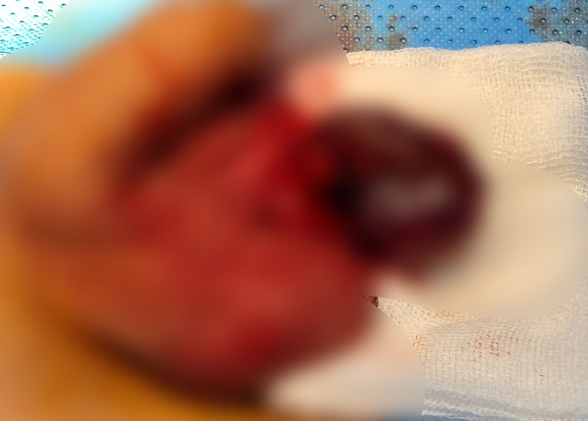 Bé trai 14 tuổi suýt mất tinh hoàn khi đang ngủ vì căn bệnh nguy hiểm với thanh thiếu niên và trẻ sơ sinh - Ảnh 1. Bé tri 14 tuổi suýt mất tinh hoàn khi đng ngủ vì căn bệnh nguy hiểm với thnh thiếu niên và trẻ sơ sinh - Ảnh 1.