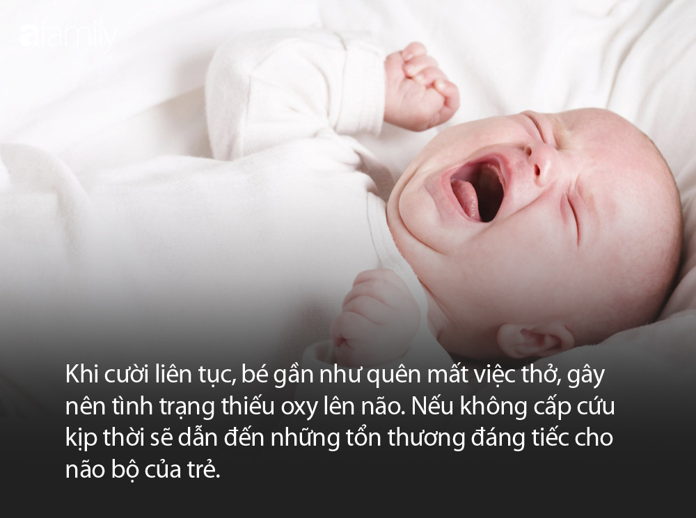 Bé gái 10 tháng phải đi cấp cứu vì bà trêu cho cười như nắc nẻ - Ảnh 2.