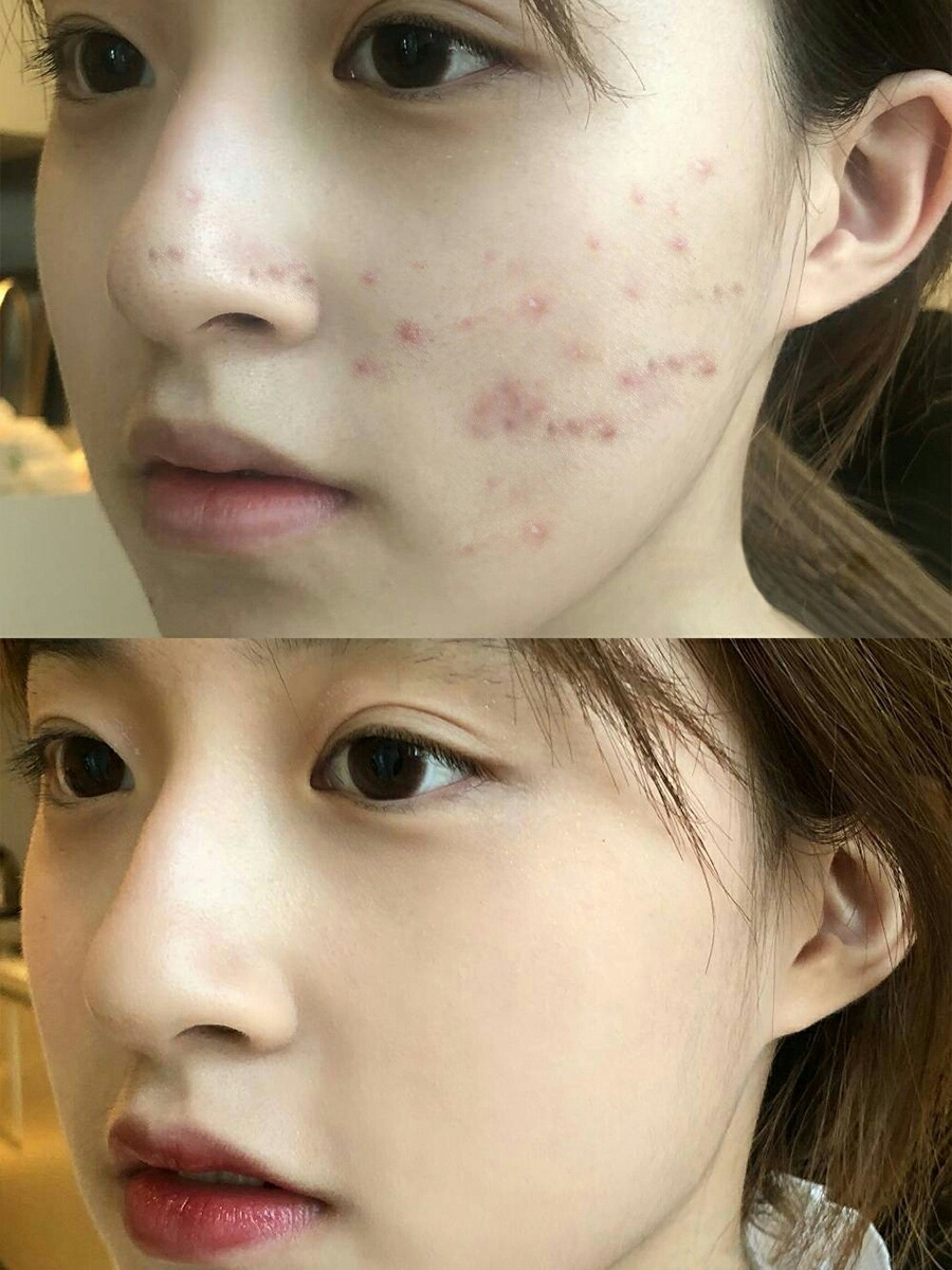 Cách chọn sữa rửa mặt theo loại da giúp da đẹp mỹ mãn - Ảnh 1.