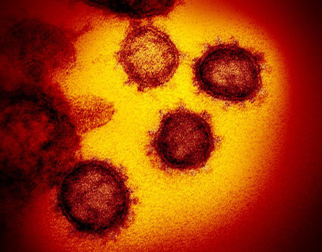 Hình ảnh thật sự của virus corona Covid-19 mới được trình diện - Ảnh 4.