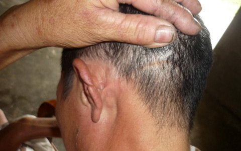 hang-xom-bat-luc-nhin-chong-dao-huyet-doi-chon-song-vo