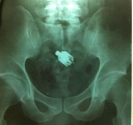 Hết hồn v&igrave; 