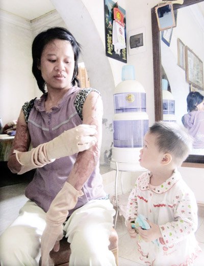Nghiệt ng&atilde; phận đời bị chồng bỏ mặc trong bệnh viện 