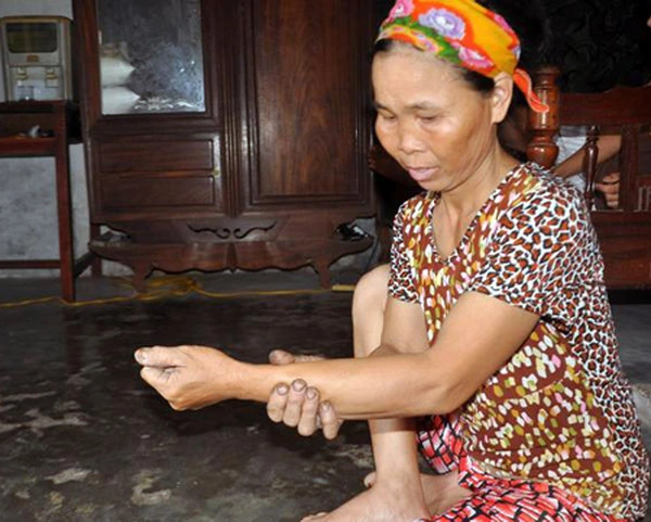 Chuyện lạ lùng về 7 phụ nữ Việt năm 2012 3