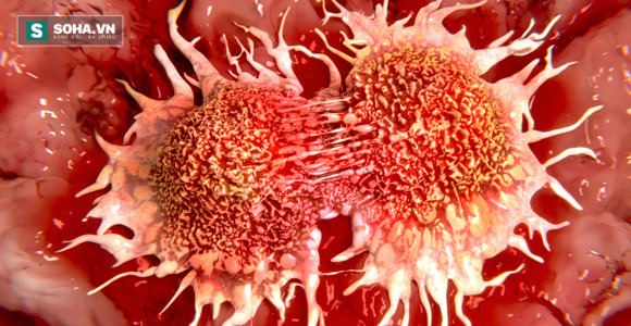 Tìm thấy hoạt chất khiến tế bào ung thư tự sát trong 30 phút - Ảnh 1.