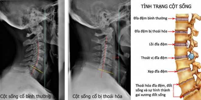 Cảnh báo căn bệnh sinh ra bách bệnh, ai cũng nên biết sớm để phòng chữa đúng cách - Ảnh 1.