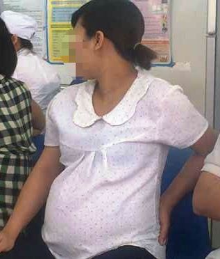 Mẹ bầu phải nhập viện vì tăng cân quá nhiều