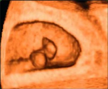 Nhìn tận mắt sự phát triển của bào thai (P1)