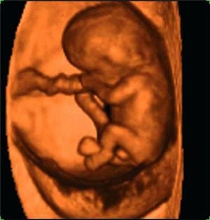 Nhìn tận mắt sự phát triển của bào thai (P1)