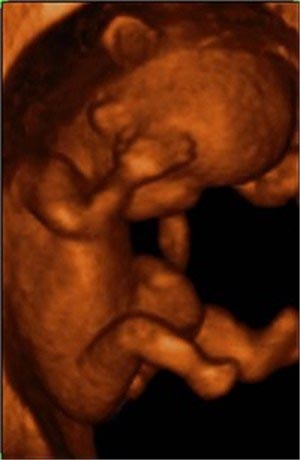 Nhìn tận mắt sự phát triển của bào thai (P2)
